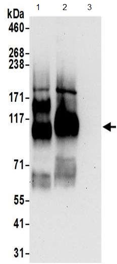 All lanes : Anti-Endoglycan antibody (ab191173) at 1 µg/mlLane 1 : HeLa whole cell lysate prepared using RIPA lysis bufferLane 2 : 293T whole cell lysate prepared using RIPA lysis bufferLane 3 : Jurkat whole cell lysate prepared using RIPA lysis bufferLysates/proteins at 50 µg per lane.developed using the ECL technique