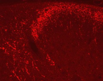 ab10289, at a dilution of 1/300, staining Endomorphin 2 in rat dorsal horn by Immunohistochemistry (PFA perfusion fixed frozen sections).