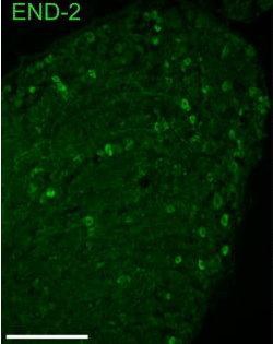 END-2 staining of neurons from neonatal rat lumbar (L4/5) DRG