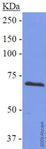 Anti-COX2 / Cyclooxygenase 2 antibody (ab52237) (Human mesothelioma whole cell lysate.)SecondaryGoat anti-rabbit HRP