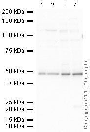 All lanes : Anti-Endothelin B Receptor antibody (ab39960) at 1 µg/mlLane 1 : MCF7 (Human breast adenocarcinoma cell line) Whole Cell Lysate Lane 2 : MDA MB 361 (Human breast adenocarcinoma cell line) Whole Cell LysateLane 3 : SW480 (Human colon adenocarcinoma cell line) Whole Cell LysateLane 4 : LOVO (Human colon adenocarcinoma cell line) Whole Cell Lysate Lysates/proteins at 20 µg per lane.SecondaryGoat polyclonal to Rabbit IgG - H&L - Pre-Adsorbed (HRP) at 1/3000 dilutionPerformed under reducing conditions.