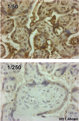 ab39960 staining human placenta sections in IHC-P. The tissue was fixed with formaldehyde and a heat mediated antigen retrival step was performed. Blocking of the sample was done with 5 minutes of peroxidase block and 10 minutes of protein block, followed by staining with ab39960 at 1/200 for 45 minutes at 20°C. A HRP conjugated goat anti-rabbit polyclonal antibody was used as the secondary antibody.