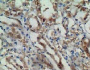 ab85086, at a 1/100 dilution, staining ENO1 in the cytoplasm and membrane of formalin fixed, paraffin embedded renal tubules by Immunohistochemistry.