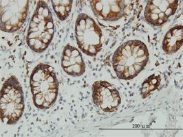 ENO3 antibody (ab54981) used in immunohistochemistry at 3ug/ml on formalin fixed and paraffin embedded human colon.