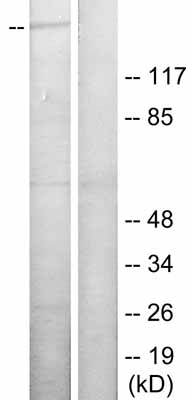 All lanes : Anti-eNOS (phospho S1177) antibody (ab51038) at 1/500 dilutionLane 1 : HeLa cell extract treated with Insulin (0.01 U/ml for 15min), with the immunising peptideLane 2 : HeLa cell extract treated with Insulin (0.01 U/ml for 15min), without the immunising peptide