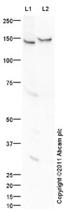All lanes : Anti-eNOS antibody (ab95254) at 1 µg/mlLane 1 : Placenta (Human) Tissue Lysate - adult normal tissue (ab29745)Lane 2 : HUVEC (Human Umbilical Vein Endothelial Cell) Whole Cell Lysate Lysates/proteins at 10 µg per lane.SecondaryGoat polyclonal Secondary Antibody to Rabbit IgG - H&L (HRP), pre-adsorbed at 1/5000 dilutiondeveloped using the ECL techniquePerformed under reducing conditions.
