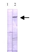 Cell lysate from Pulmonary artery endothelial cells were probed by preimmune serum (line 1) or anti-eNOS (ab3868) (Lane 2).