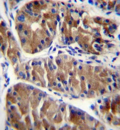 Immunohistochemical analysis of paraffin embedded Human stomach tissue labeling ENOX2 with ab171420 at 1/10 followed by peroxidase conjugation of the secondary antibody and DAB staining.