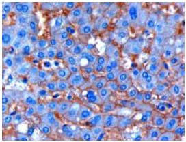 Ab40003 (1ug/ml) staining human ENPP1 in human liver tissue by immunohistochemistry using paraffin embedded tissue. Microwaved antigen retrieval with citrate buffer pH 6, HRP-staining.