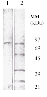 Lane 1: Cox-2 (protein standard prepared from ovine placenta, supplied by Alpha Diagnostic International).Lane 2: MM standardAntibody 5E10/D10: 1 µg/ml