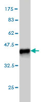 Western blot against tagged recombinant protein immunogen using ab55580 ENPP3 antibody at 1ug/ml.