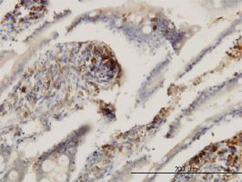 ENTPD6 antibody (ab54957) used in immunohistochemistry at 3ug/ml on formalin fixed and paraffin embedded human small Intestine.