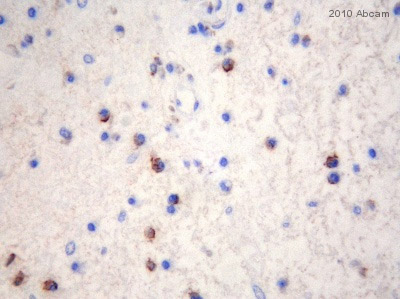 ab8018 staining Eotaxin in Human nasal polyp and tonsil tissue sections by Immunohistochemistry (resin-embedded sections). The tissue was fixed in acetone and inhibitors and embedded into GMA resin. Samples were incubated with primary antibody (1/250 in Tris buffered saline) for 18 hours at 4°C. A Biotin-conjugated Pig anti-rabbit polyclonal (1/1200) was used as the secondary antibody.See Abreview