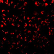 Immunofluorescence of Eotaxin in 293 cells using ab8018 at 10 ug/ml.