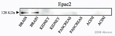 Anti-Epac2 antibody (ab21238) at 1/1000 dilution + Whole cell lysates prepared from rabbit brain (positive control) and kidney, pancreas and pancretic acini (negative controls) at 20 µgSecondaryHRP-conjugated goat anti-rabbit IgGPerformed under reducing conditions.