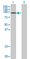 All lanes : Anti-EPB4IL2 antibody (ab67859) at 1/500 dilutionLane 1 : EPB4IL2 transfected 293T cell lysateLane 2 : Non-transfected 293T cell lysateLysates/proteins at 25 µg per lane.SecondaryGoat Anti-Mouse IgG (H&L)-HRP Conjugate at 1/2500 dilution