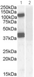 All lanes : Anti-EPB4IL2 antibody (ab77263) at 0.1 µg/mlLane 1 : Human cerebellum lysate in RIPA bufferLane 2 : Human cerebellum lysate in RIPA buffer with immunising peptideLysates/proteins at 35 µg/ml per lane.developed using the ECL technique