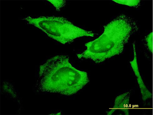 Immunofluorescence analysis of HeLa cells, staining EPCR/CD201 with ab56689 at 10 µg/ml.