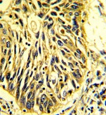 Immunohistochemical analysis of formalin fixed, paraffin-embedded Human lung tissue labeling EPCR/CD201 with ab174234 at a 1/50 dilution, peroxidase-conjugated to the secondary antibody and followed by DAB staining.
