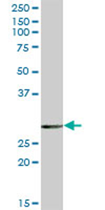 Anti-EPDR1 antibody (ab69306) at 1/500 dilution + rat brain tissue lysate at 25 µgSecondaryGoat Anti-Mouse IgG (H&L)-HRP Conjugate at 1/2500 dilution
