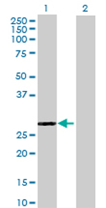 All lanes : Anti-EPDR1 antibody (ab69306) at 1/500 dilutionLane 1 : EPDR1 transfected 293T cell lysateLane 2 : Non-transfected 293T cell lysateLysates/proteins at 25 µg per lane.SecondaryGoat Anti-Mouse IgG (H&L)-HRP Conjugate at 1/2500 dilution