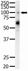 Anti-Eph receptor A1 antibody (ab5376) at 1/100 dilution + HeLa cell lysate