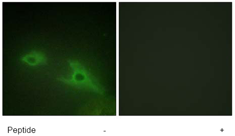 Immunofluorescence analysis of HeLa cells ab65074 (1/50). The left panel is in the absence of blocking peptide, whereas the right panel is in the presence of blocking peptide.