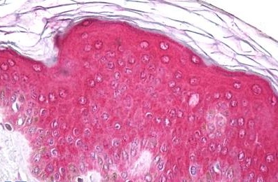 Immunohistochemical analysis of paraffin embedded Human Skin, Epidermis tissue labelling Eph receptor A1 with ab150478 antibody at a concentration of 10 µg/ml.