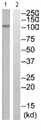 All lanes : Anti-Eph receptor A2 antibody (ab110690) at 1/500 dilutionLane 1 : COLO205 cell lysateLane 2 : COLO205 cell lysate with blocking peptide at 10 µgLysates/proteins at 30 µg per lane.