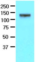 Anti-Eph receptor A2 antibody [3D7] (ab118882) at 1/500 dilution + Mouse brain extracts at 50 µgSecondaryGoat anti-Mouse conjugated to HRPdeveloped using the ECL technique