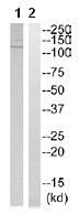 All lanes : Anti-Eph receptor A3 antibody (ab110465) at 1/500 dilutionLane 1 : Extracts from 293 cellsLane 2 : Extracts from 293 cells, treated with the synthesized peptideLysates/proteins at 30 µg per lane.
