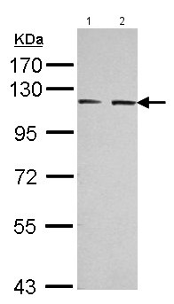 All lanes : Anti-Eph receptor A3 antibody (ab126261) at 1/3000 dilutionLane 1 : Juakat cell lysateLane 2 : Raji cell lysateLysates/proteins at 30 µg per lane.