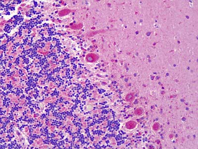 ab113239, at 10 µg/ml, staining Eph receptor A6 in Formalin-fixed, Paraffin-embedded Human Brain cerebellum tissue by Immunohistochemistry.