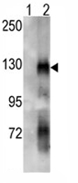 All lanes : Anti-Eph receptor A6 antibody (ab80207) at 1/50 dilutionLane 1 : Non-transfected 293 cell lysates Lane 2 : Eph receptor A6 transfected 293 cell lysates Lysates/proteins at 2 µg per lane.