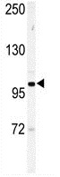 Anti-Eph receptor A6 antibody - C-terminal (ab135807) at 1/100 dilution + mouse stomach tissue lysates at 35 µg