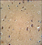 Immunohistochemical analysis of formalin fixed, paraffin embedded Human brain tissue labelling Eph receptor A6 with ab135807 at 1/50 dilution, followed by peroxidase-conjugated secondary antibody and DAB staining.