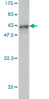 Western blot against tagged recombinant protein immunogen using ab54640 Eph receptor A7 antibody at 1ug/ml.