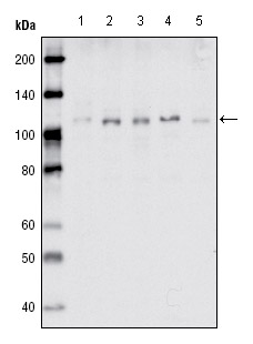 All lanes : Anti-Eph receptor B1 antibody [5F10A4] (ab66326) at 1/2000 dilutionLane 1 : Cell lysates prepared from MDA-MB-468 cellsLane 2 : Cell lysates prepared from MDA-MB-453 cellsLane 3 : Cell lysates prepared from MCF-7 cellsLane 4 : Cell lysates prepared from T47D cellsLane 5 : Cell lysates prepared from SKBR-3 cellsLysates/proteins at 100 µg per lane.SecondaryHRP-conjugated Goat polyclonal to mouse IgG