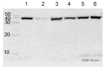 All lanes : Anti-CNPase antibody [11-5B] (ab6319) at 1/500 dilutionLane 1 : 40ug rat brain homegenate (whole tissue lysate) animal #661Lane 2 : 40ug rat brain homegenate (whole tissue lysate) animal #655Lane 3 : 40ug rat brain homegenate (whole tissue lysate) animal #668Lane 4 : 40ug rat brain homegenate (whole tissue lysate) animal #662Lane 5 : 40ug rat brain homegenate (whole tissue lysate) animal #659Lane 6 : 40ug rat brain homegenate (whole tissue lysate) animal #670SecondaryHRP conjugated goat anti-mouse antibodydeveloped using the ECL techniquePerformed under reducing conditions.