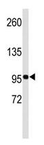 Anti-Eph receptor B3 antibody (ab95224) at 1/50 dilution + C6 cell line lysate at 35 µg