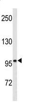Anti-Eph receptor B3 antibody (ab95224) at 1/50 dilution + mouse stomach tissue lysate at 35 µg