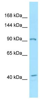 Anti-Eph receptor B3 antibody (ab133879) at 1 µg/ml + H1080 cell lysate at 10 µg