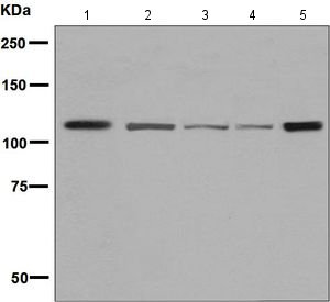 All lanes : Anti-Eph receptor B3 antibody [EPR8280] (ab133742) at 1/1000 dilutionLane 1 : Jurkat cell lysateLane 2 : HeLa cell lysateLane 3 : HepG2 cell lysateLane 4 : MOLT4 cell lysateLane 5 : NIH3T3 cell lysateLysates/proteins at 10 µg per lane.SecondaryGoat anti-Rabbit HRP at 1/2000 dilution