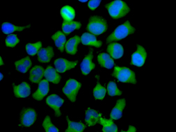 Immunocytochemical analysis of HeLa cells labelling Eph receptor B3 with ab133742 at 1/100.