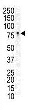 Anti-Eph receptor B3 antibody - N-terminal (ab135809) at 1/100 dilution + Jurkat cell lysate at 12.5 µgSecondaryHRP-anti-rabbit developed using the ECL technique