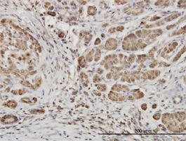 Eph receptor B6 antibody (ab54656) used in immunohistochemistry at 3ug/ml on formalin fixed and paraffin embedded human pancreas.