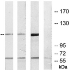 Lanes 1 - 3 : Anti-Eph receptor B6 antibody - C-terminal (ab139376) at 1/500 dilutionLane 4 : Lane 1 : extract from HeLa cellsLane 2 : extract from 296 cellsLane 3 : extract from COLO 205 cellsLane 4 : extract from COLO 205 cells with synthesized peptide