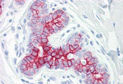 Immunohistochemical analysis of formalin fixed, paraffin embedded Human breast tissue labeling Eph receptor B6 with ab139376 at 10 µg/ml.
