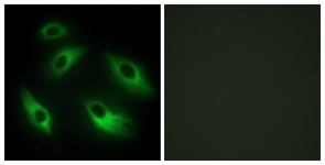 Immunofluorescence analysis of HeLa cells labelling Eph receptor B6 with ab139376 at 10µg/ml. The image on the right is treated with the synthesized peptide.