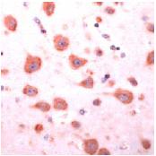 Ab28385, at a dilution of 1/100, staining Ephrin A4 in formalin fixed paraffin embedded human brain sections by Immunohistochemistry.